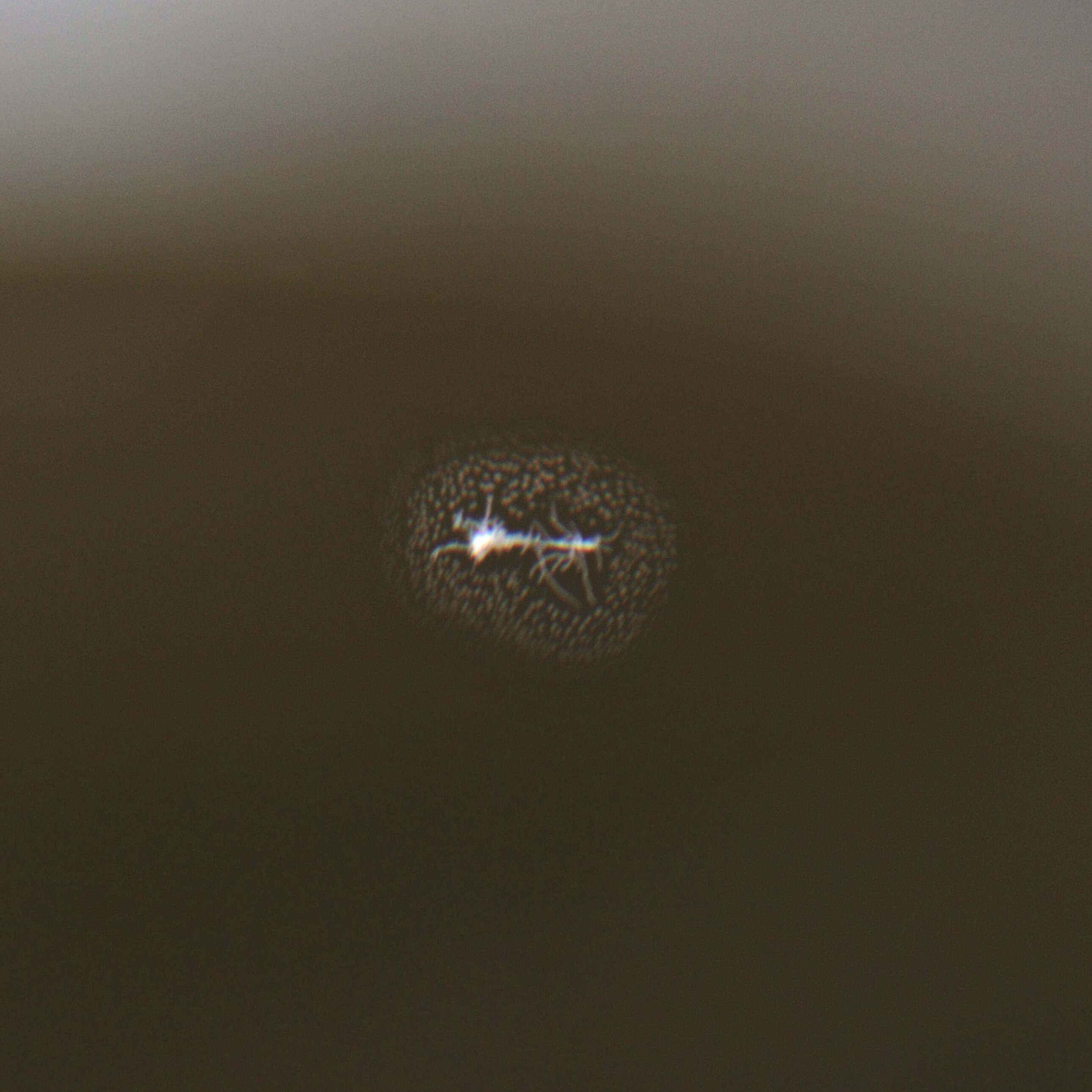 Small fungus in lens